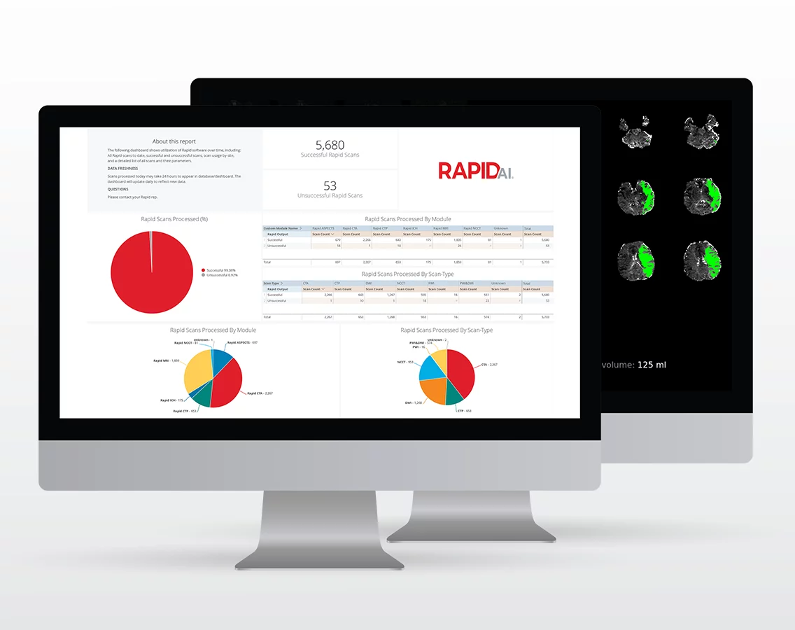 Activa - RapidAI monitor